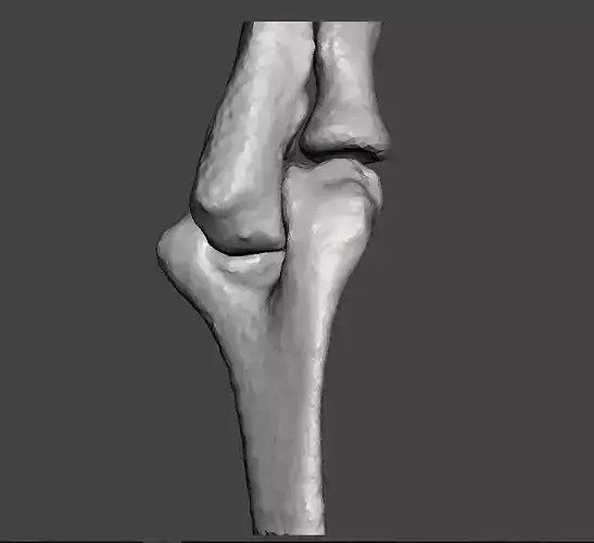 Right elbow - female - age 37 3D model