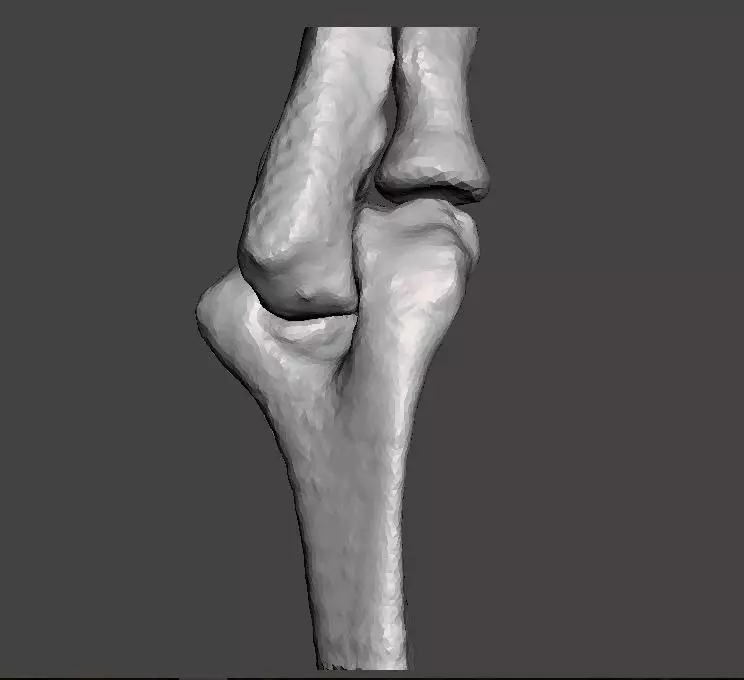 Right elbow - female - age 37 3D model_0