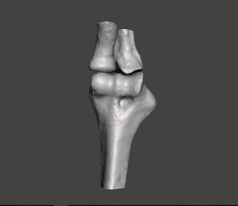 Right elbow - female - age 37 3D model_4