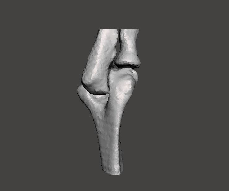 Right elbow - female - age 37 3D model_3
