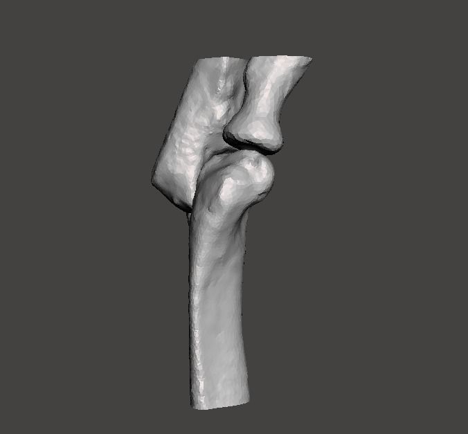 Right elbow - female - age 37 3D model_1