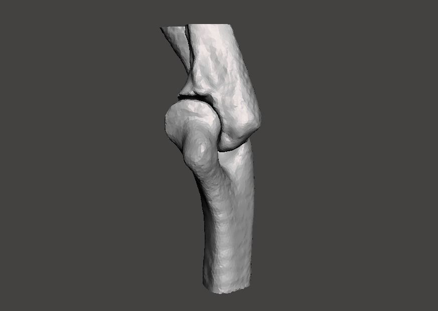 Right elbow - female - age 37 3D model_5