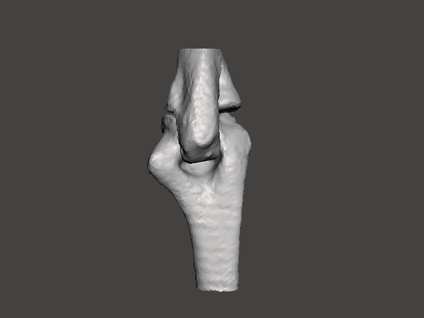 Right elbow - female - age 37 3D model_8
