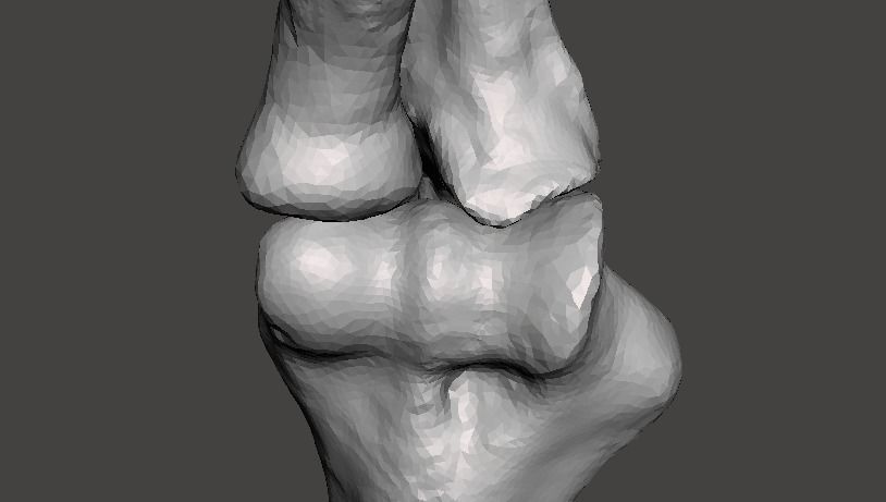 Right elbow - female - age 37 3D model_6