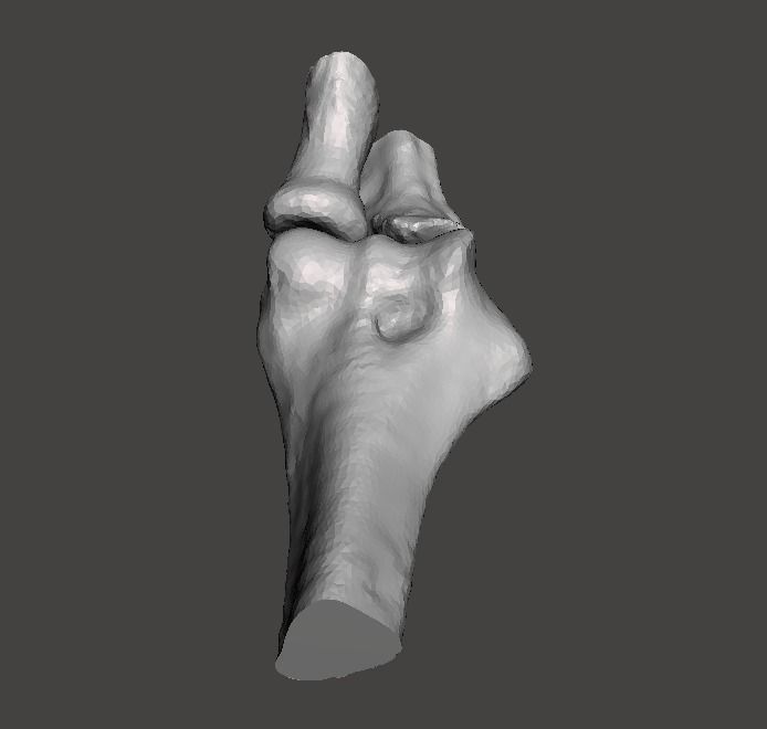 Right elbow - female - age 37 3D model_7