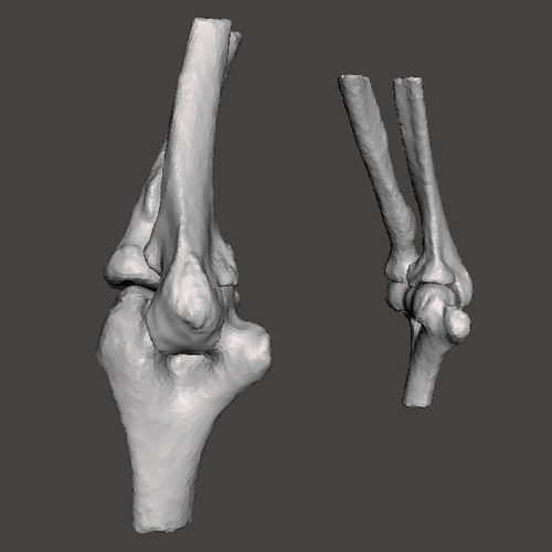Elbows - male- age 49 3D model