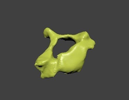 Cervical Vertebra 3D model