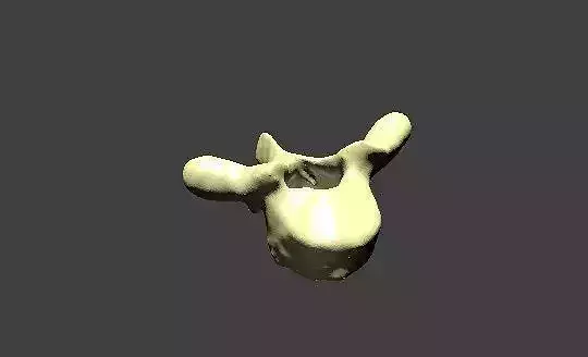Thoracic Vertebra