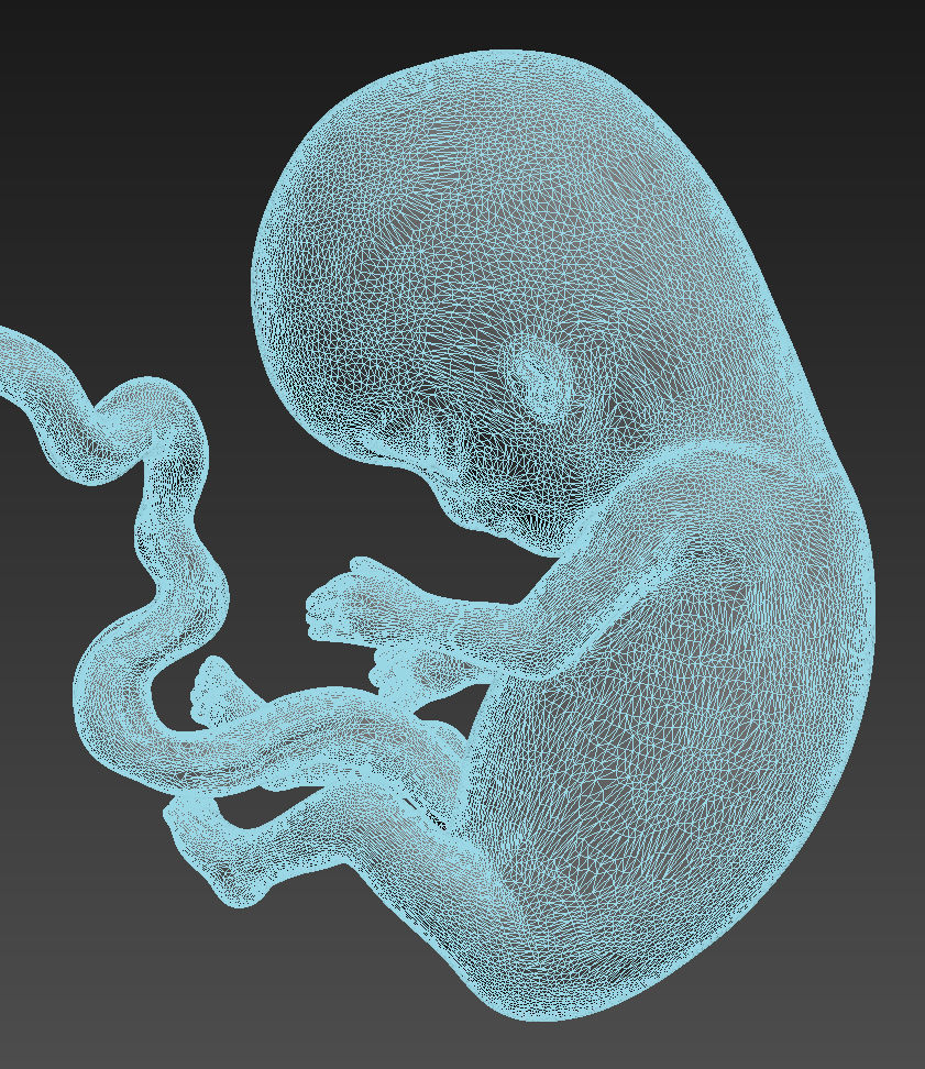 Human embryo 3D model_6