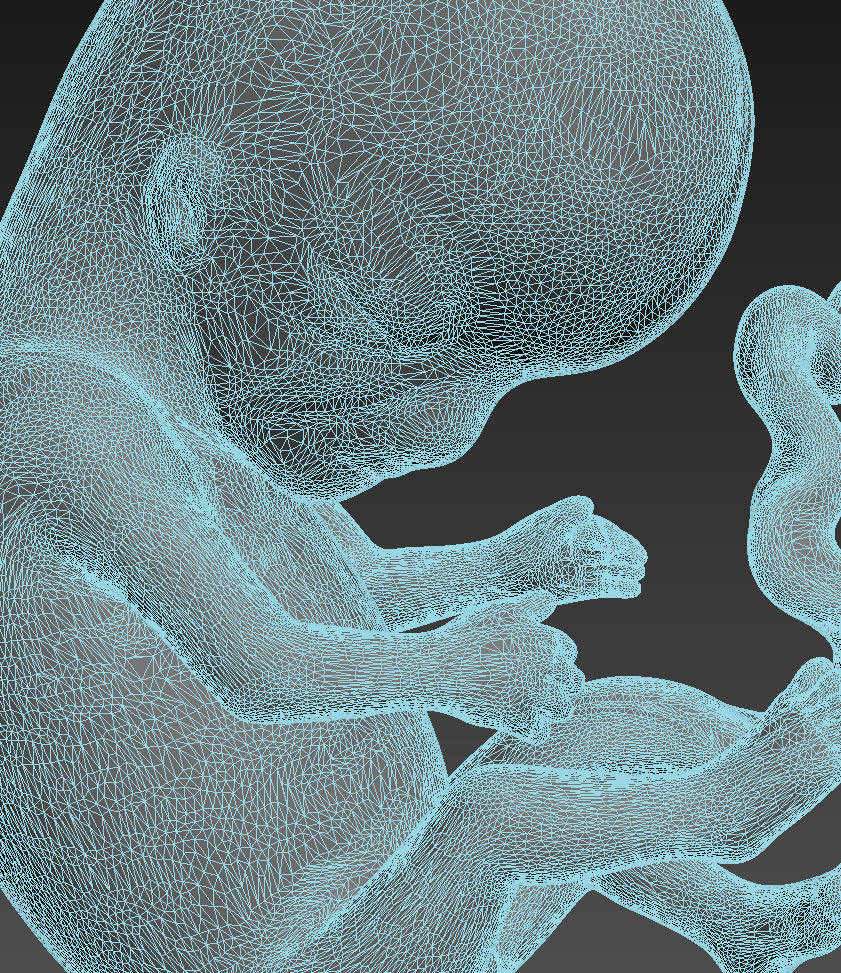 Human embryo 3D model_7