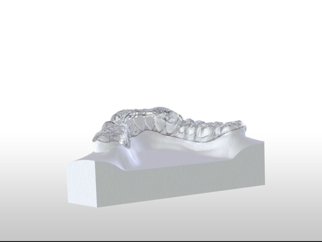 Digital Ortho Tanner Repositioner  3D print model_9