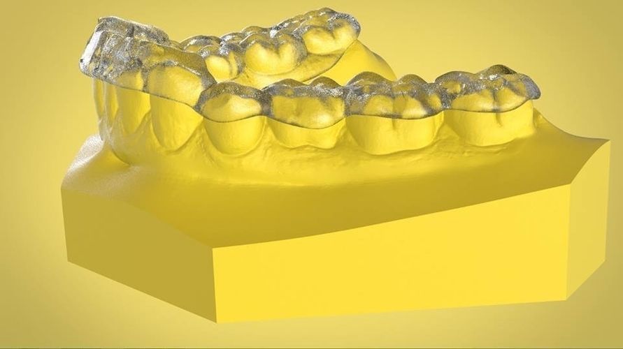 Digital Ortho Tanner Repositioner  3D print model_3