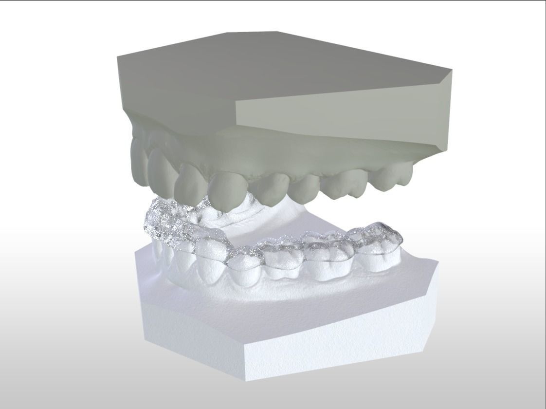 Digital Ortho Tanner Repositioner  3D print model_8