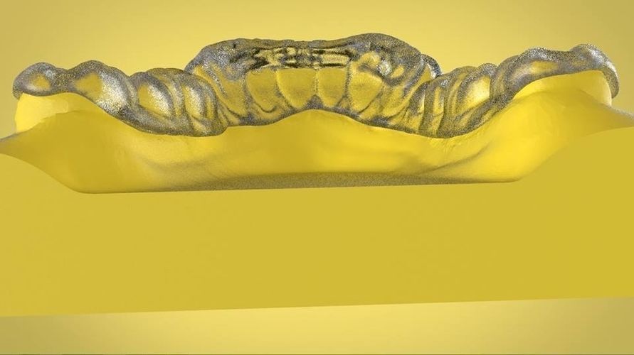 Digital Ortho Tanner Repositioner  3D print model_5