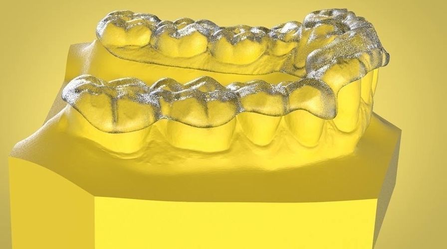 Digital Ortho Tanner Repositioner  3D print model_6