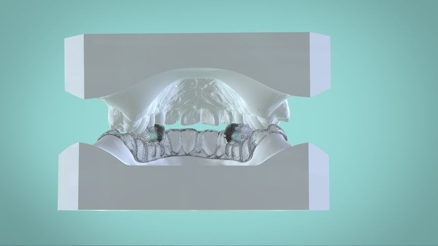 Digital Morning Repositioning Deprogrammer 3D print model_8