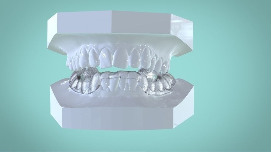 Digital Morning Repositioning Deprogrammer 3D print model_4