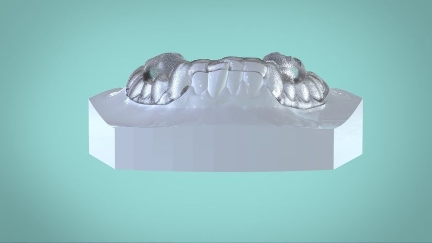 Digital Morning Repositioning Deprogrammer 3D print model_6