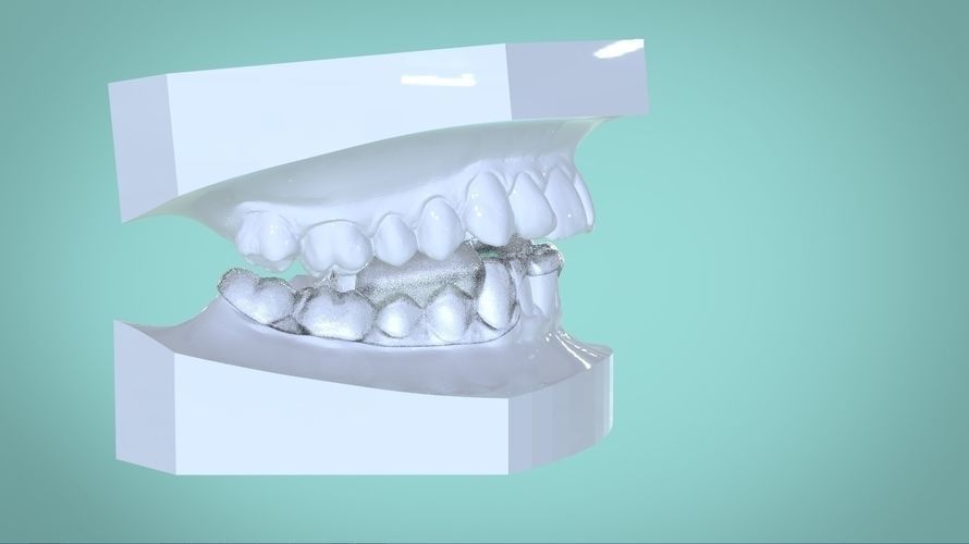 Digital Morning Repositioning Deprogrammer 3D print model_3