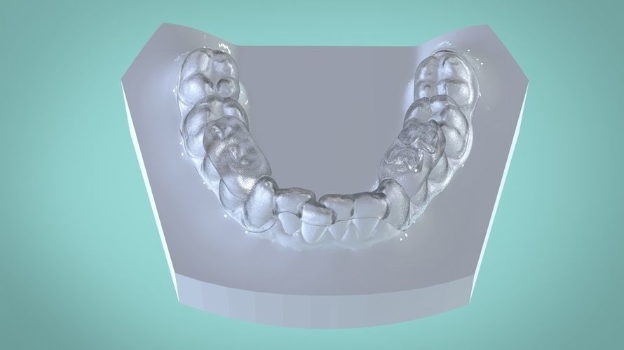 Digital Morning Repositioning Deprogrammer 3D print model_5