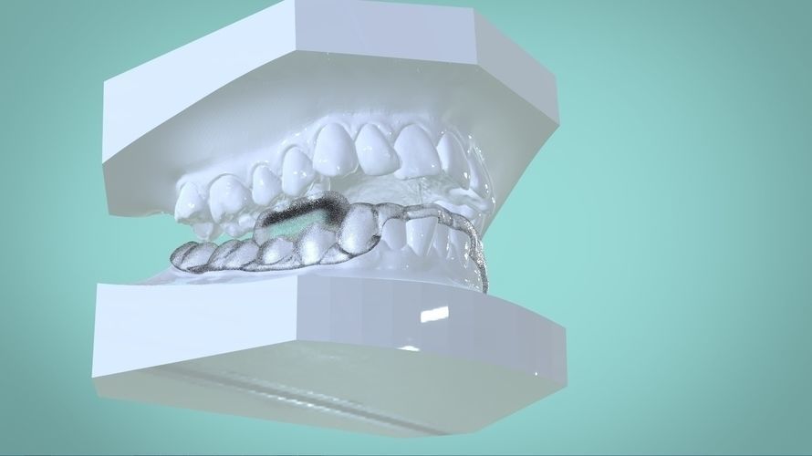 Digital Morning Repositioning Deprogrammer 3D print model_7