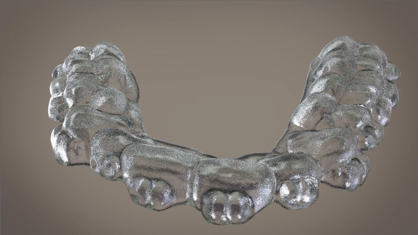 Digital Orthodontic Indirect Bonding Tray 3D print model_10