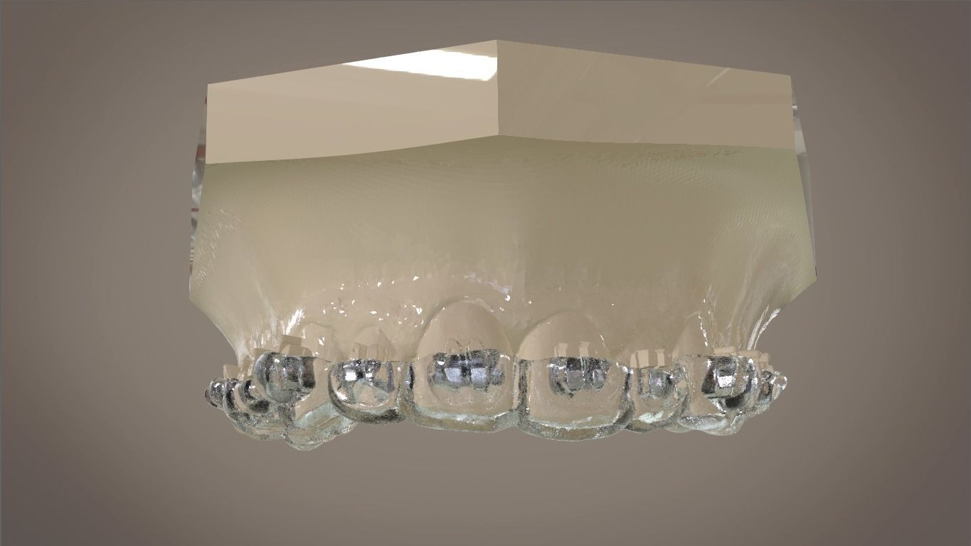 Digital Orthodontic Indirect Bonding Tray 3D print model_15