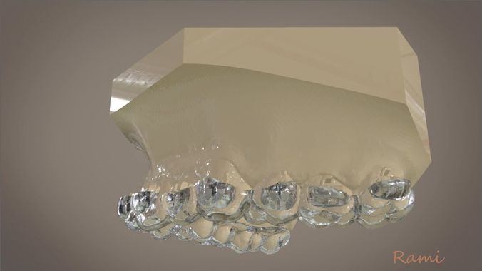 Digital Orthodontic Indirect Bonding Tray 3D print model