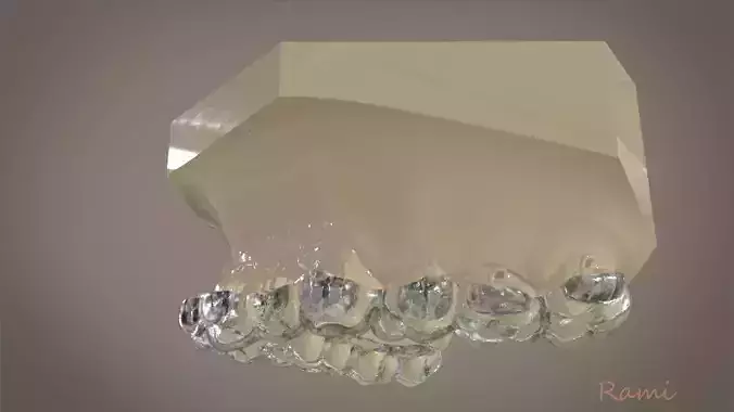 Digital Orthodontic Indirect Bonding Tray 3D print model