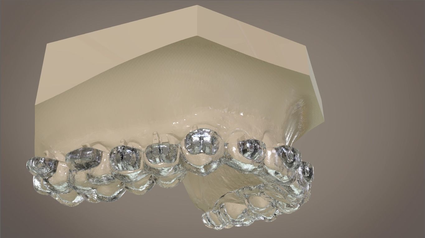 Digital Orthodontic Indirect Bonding Tray 3D print model_17