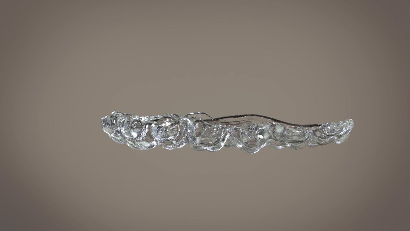 Digital Orthodontic Indirect Bonding Tray 3D print model_1