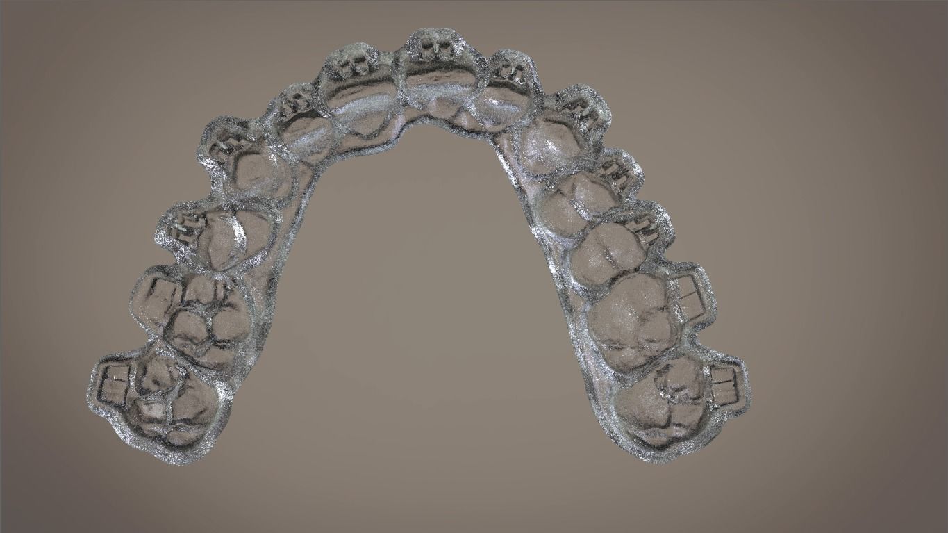 Digital Orthodontic Indirect Bonding Tray 3D print model_13