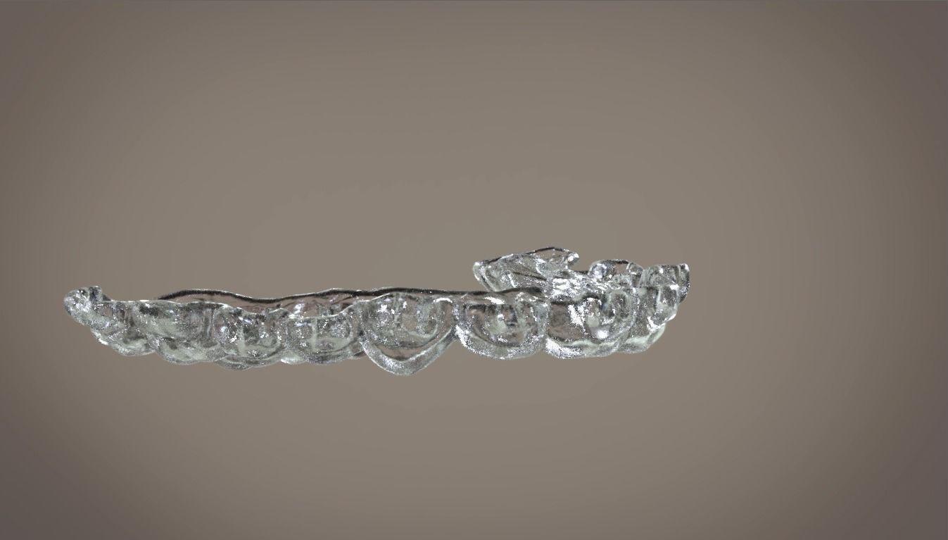 Digital Orthodontic Indirect Bonding Tray 3D print model_14
