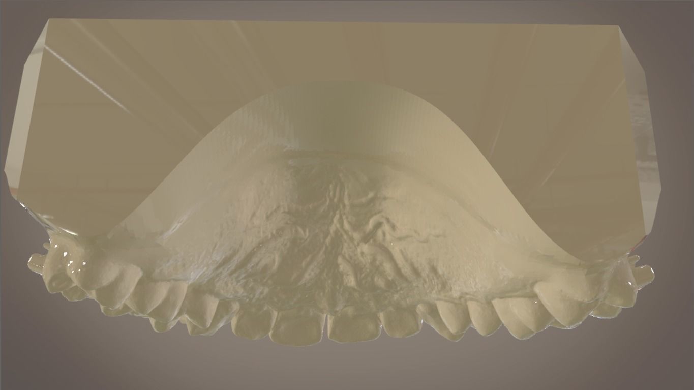 Digital Orthodontic Indirect Bonding Tray 3D print model_6