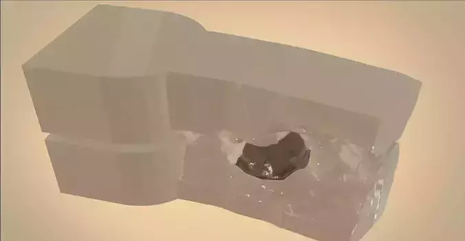 Digital Dental Quadrant Model