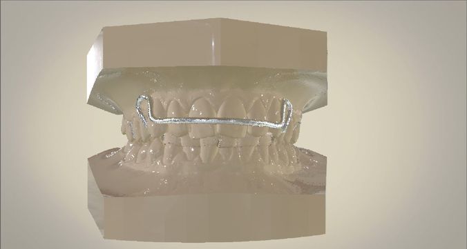 Digital Activator Appliance 3D print model