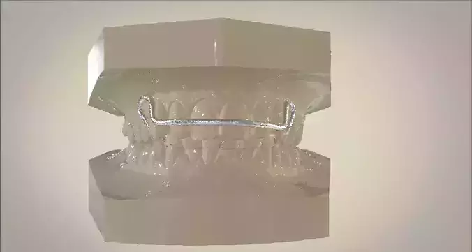 Digital Activator Appliance 3D print model