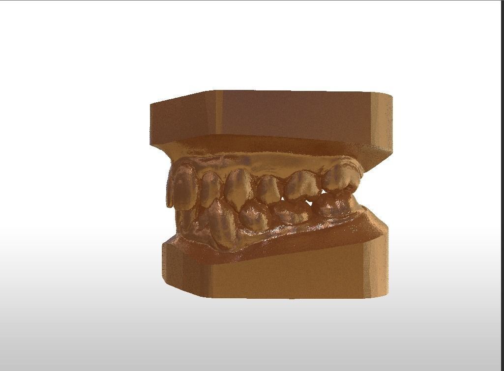 Digital Study Orthodontics Archman Models 3D print model_20