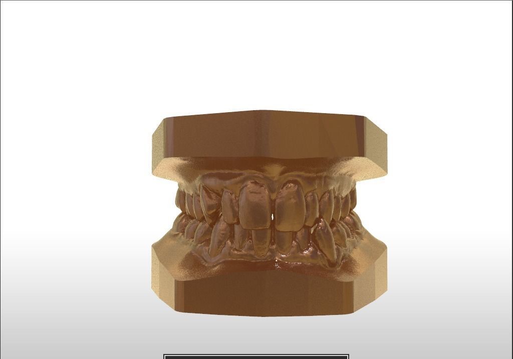 Digital Study Orthodontics Archman Models 3D print model_18