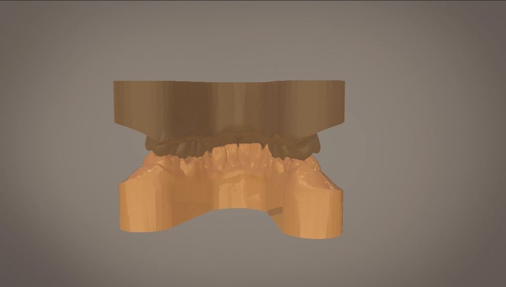 Digital Study Orthodontics Archman Models 3D print model_9
