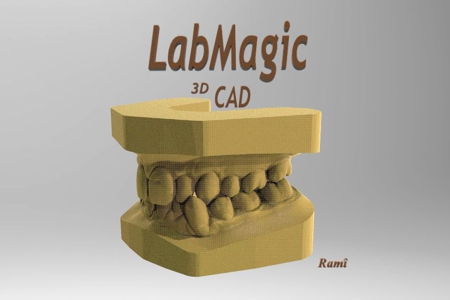 Digital Study Orthodontics Archman Models 3D print model_11