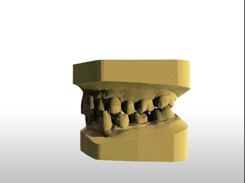 Digital Study Orthodontics Archman Models 3D print model_14