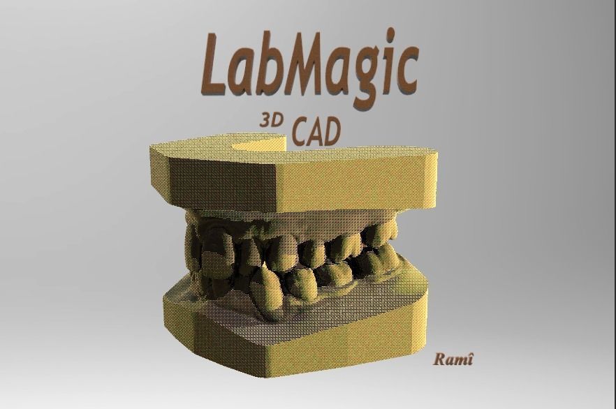 Digital Study Orthodontics Archman Models 3D print model_12