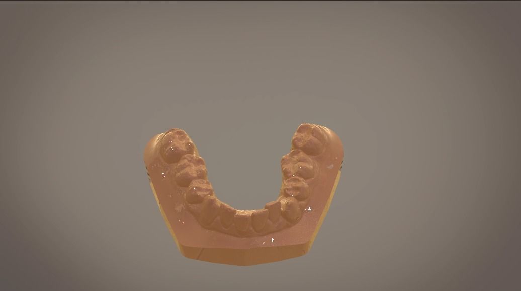 Digital Study Orthodontics Archman Models 3D print model_10