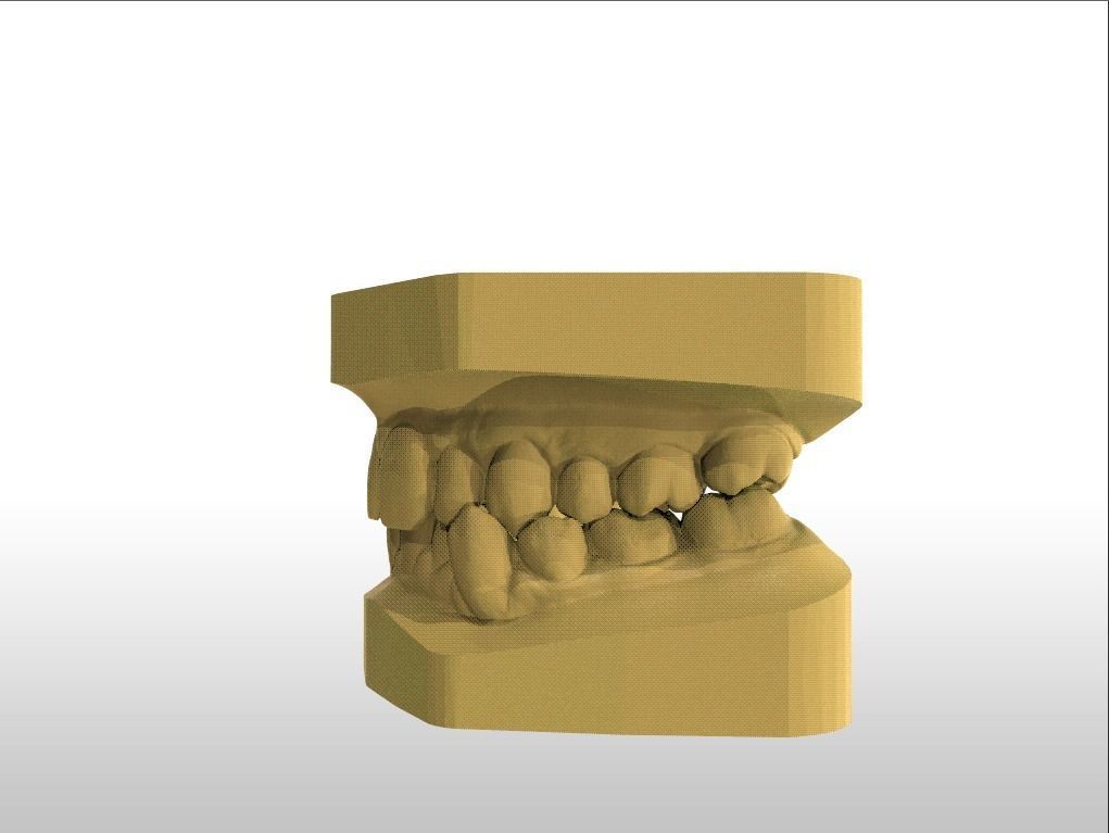 Digital Study Orthodontics Archman Models 3D print model_13