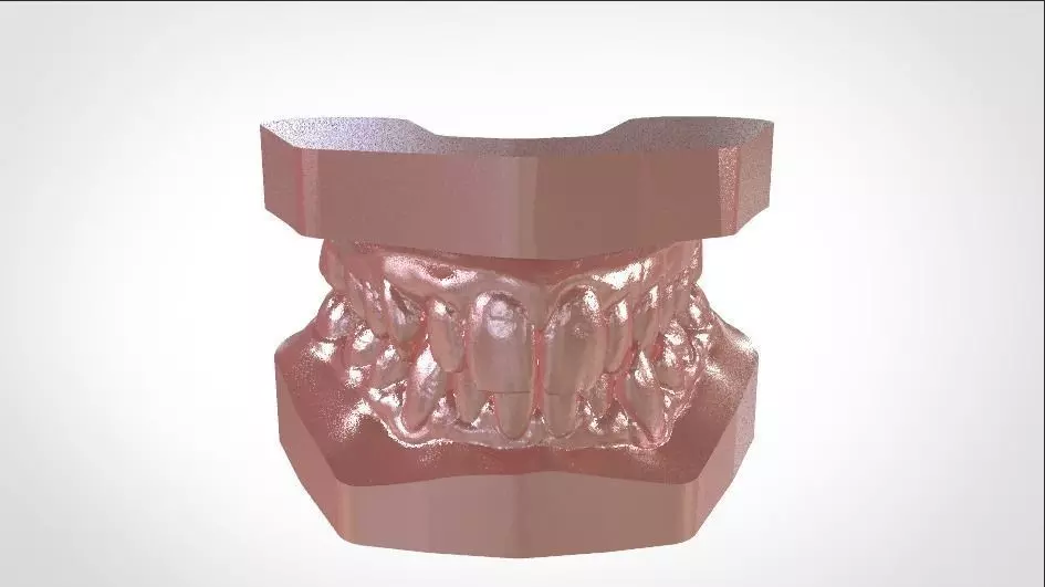 Digital Study Orthodontics Archman Models 3D print model_0