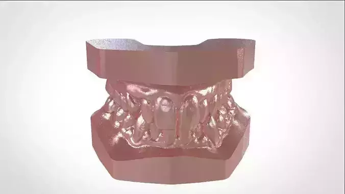 Digital Study Orthodontics Archman Models 3D print model