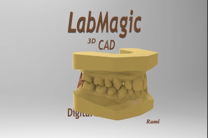 Digital Study Orthodontics Archman Models 3D print model_2