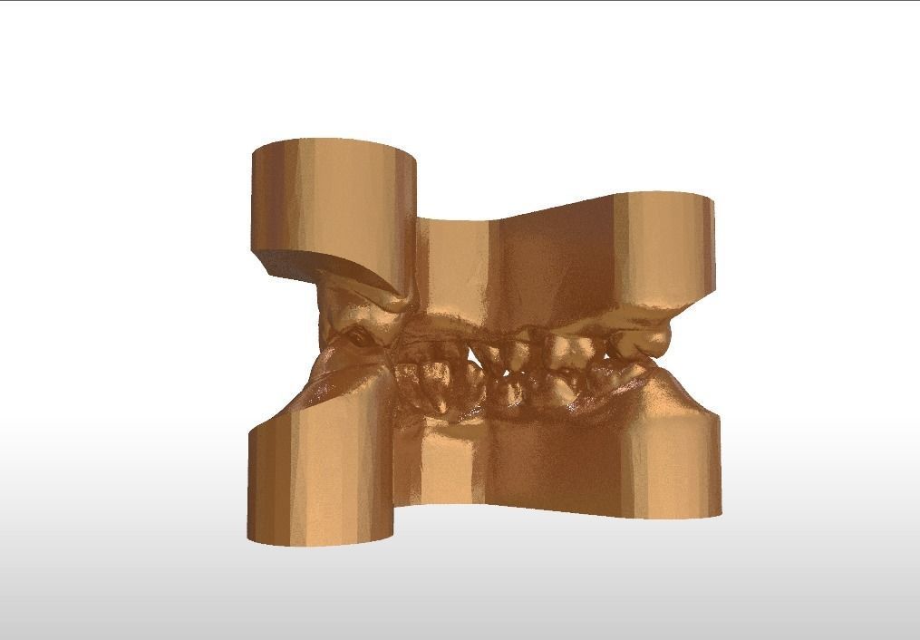 Digital Study Orthodontics Archman Models 3D print model_22
