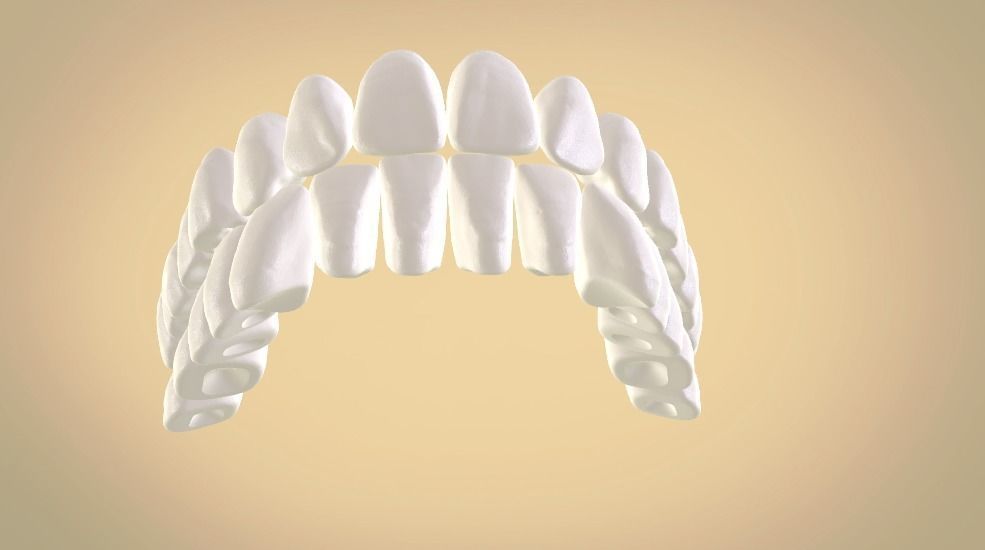 Full Dentures With Many Production Options 3D print model_12
